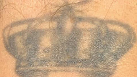 a close up of a tattoo