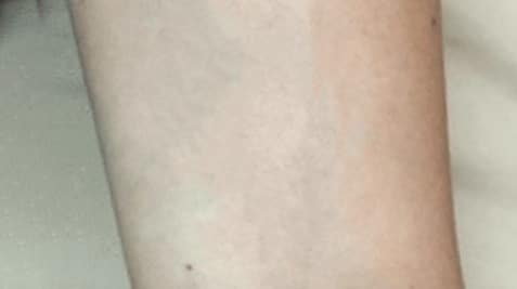 a tattoo on his arm