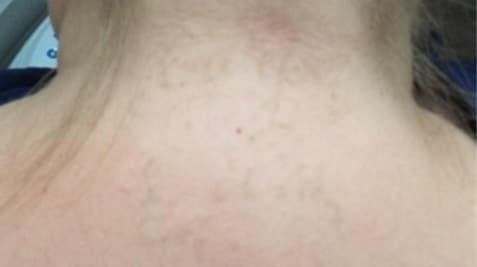 a close up of a tattoo on his head
