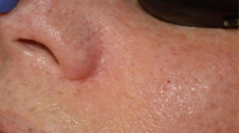 a close up of a persons mouth