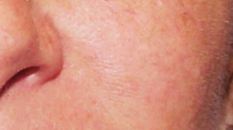 a close up of a tattoo