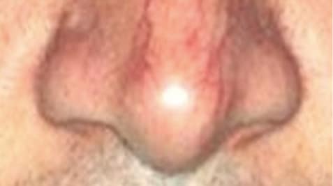 a close up of a tattoo on their face